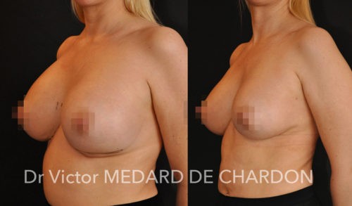 cornil sylvain david volpei gasnier chirurgie esthetique