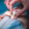 chirurgie-nez-attelle